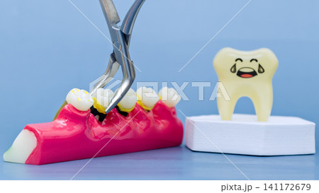 Dental forceps extracting a decayed tooth from a jaw model. Concept of dental surgery, toothache, and fear of dentist with sad crying cartoon tooth. 141172679