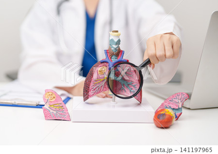 Doctor with Smoker and normal Lung anatomy for Disease. Lung Cancer, Asthma, Chronic Obstructive Pulmonary or COPD, Bronchitis, Emphysema, Cystic Fibrosis, Bronchiectasis, Pneumonia and world Lung day Doctor with Smoker and normal Lung anatomy for Disease. Lung Cancer, Asthma, Chronic Obstructive Pulmonary or COPD, Bronchitis, Emphysema, Cystic Fibrosis, Bronchiectasis, Pneumonia and world Lung day 141197965