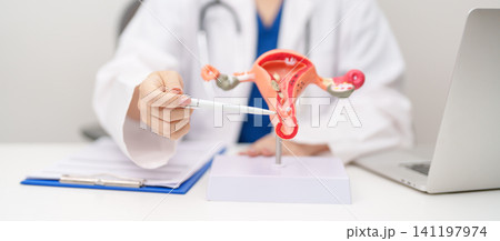 Doctor with Uterus and Ovaries anatomy model. Ovarian and Cervical cancer, Cervix disorder, Endometriosis, Hysterectomy, Uterine fibroids, Reproductive system, Pregnancy and health concept Doctor with Uterus and Ovaries anatomy model. Ovarian and Cervical cancer, Cervix disorder, Endometriosis, Hysterectomy, Uterine fibroids, Reproductive system, Pregnancy and health concept 141197974