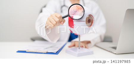 Doctor with human Eye anatomy model with magnifying glass. Eye disease, Refractive Errors, Age Related Macular Degeneration, Cataract, Diabetic Retinopathy, Glaucoma, Amblyopia, Strabismus and Health Doctor with human Eye anatomy model with magnifying glass. Eye disease, Refractive Errors, Age Related Macular Degeneration, Cataract, Diabetic Retinopathy, Glaucoma, Amblyopia, Strabismus and Health 141197985