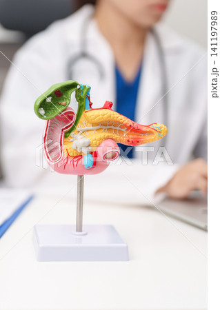 Doctor with human Pancreatitis anatomy model with Pancreas, Gallbladder, Bile Duct, Duodenum, Small intestine. Pancreatic cancer, Acute and Chronic pancreatitis, Digestive system and Health concept Doctor with human Pancreatitis anatomy model with Pancreas, Gallbladder, Bile Duct, Duodenum, Small intestine. Pancreatic cancer, Acute and Chronic pancreatitis, Digestive system and Health concept 141197989