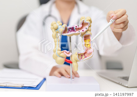 Doctor with human Colon anatomy model. Colonic disease, Large Intestine, Colorectal cancer, Ulcerative colitis, Diverticulitis, Irritable bowel syndrome, Digestive system and Healthcare concept 141197997