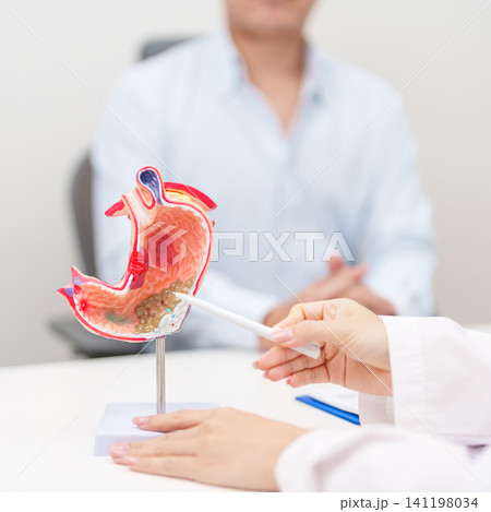 Doctor with Gastric anatomy model. Gastroenterologist consultation, stomach diseases and ulcers, November stomach cancer, Gastroesophageal Reflux Disease, GERD, Acid reflux and healthcare medical Doctor with Gastric anatomy model. Gastroenterologist consultation, stomach diseases and ulcers, November stomach cancer, Gastroesophageal Reflux Disease, GERD, Acid reflux and healthcare medical 141198034