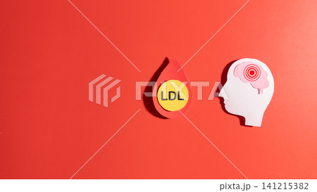 High LDL cholesterol increases the risk of stroke by boosting the risk of vascular disease. LDL cholesterol particles inside a blood droplet and human brain made from paper on red background. High LDL cholesterol increases the risk of stroke by boosting the risk of vascular disease. LDL cholesterol particles inside a blood droplet and human brain made from paper on red background. 141215382