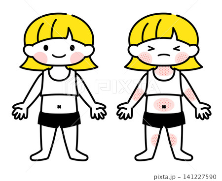 【医療・保育】湿疹(アトピー)の出ている女の子のイラスト 【医療・保育】湿疹(アトピー)の出ている女の子のイラスト 141227590
