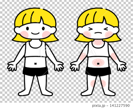 【医療・保育】湿疹(アトピー)の出ている女の子のイラスト 【医療・保育】湿疹(アトピー)の出ている女の子のイラスト 141227590
