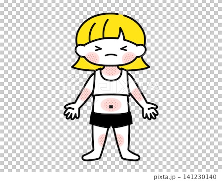 [Medical/Childcare] Illustration of a girl with eczema (atopic dermatitis) 141230140