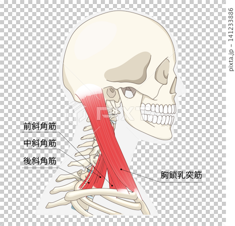 頸部肌肉側視圖解剖圖 141233886
