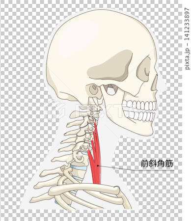 頸部肌肉側視圖解剖圖 141233897