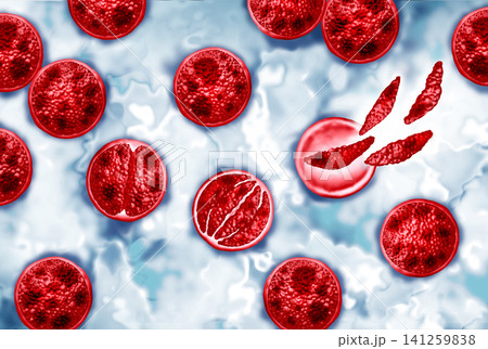 Cyclosporiasis Growth Cyclosporiasis Growth 141259838