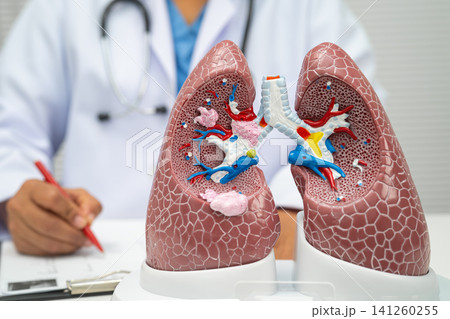 Pneumonia, lung cancer, Asian doctor with human lung model. Pneumonia, lung cancer, Asian doctor with human lung model. 141260255