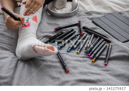 Woman hands drawing on broken leg cast. Unrecognizable girl draws with felt tip pens on orthopedic cast. Bored girl with broken leg playing at home during rehabilitation. Accident injury fracture 141275917