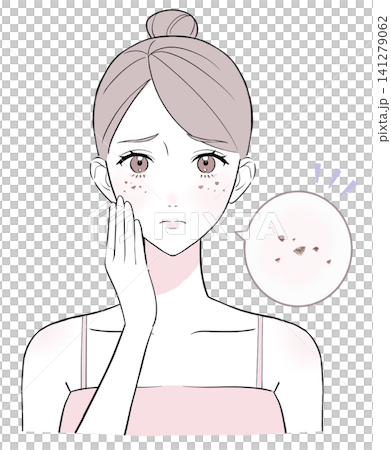 A woman suffering from facial blemishes A woman suffering from facial blemishes 141279062