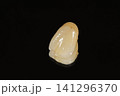 きれいなセラミックの歯にしませんか 141296370
