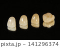 きれいなセラミックの歯にしませんか 141296374