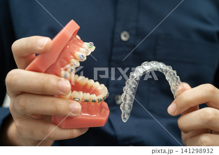 Man holding invisible aligner orthodontic retainer for dental teeth straightening. 141298932