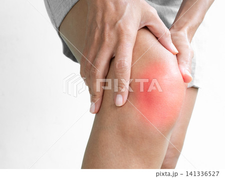 Knee pain Joint arthritis bone injury woman athlete leg sore hurt chronic acute, person muscle inflammation medicine treatment health disease arthritis strain sprain injured from fitness. 141336527