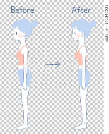 Before and after photos of a woman correcting lordosis (swayback). Before and after photos of a woman correcting lordosis (swayback). 141345035