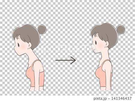 Before and After Photos of a Woman Improving Her Posture (Hunchback/Straight Neck) Before and After Photos of a Woman Improving Her Posture (Hunchback/Straight Neck) 141346437