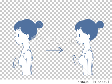 Breast augmentation before and after: Illustration of a woman Breast augmentation before and after: Illustration of a woman 141346491
