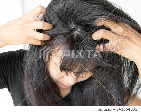 Dandruff Itchy scalp, woman chtatch hair messy she dirty, sensitive disease bacteria dander loss, concept for medicine hyginene champoo treatment skin for good health. Dandruff Itchy scalp, woman chtatch hair messy she dirty, sensitive disease bacteria dander loss, concept for medicine hyginene champoo treatment skin for good health. 141354832