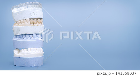 Stack of dental plaster molds with clear orthodontic aligner on top. Wide blue background with copy space. Stack of dental plaster molds with clear orthodontic aligner on top. Wide blue background with copy space. 141359037
