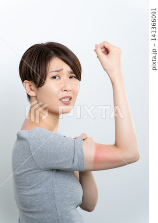 赤く日焼けする女性 141366091
