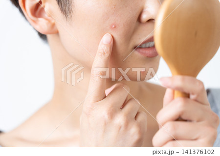 顔のにきびに悩む女性 顔のにきびに悩む女性 141376102