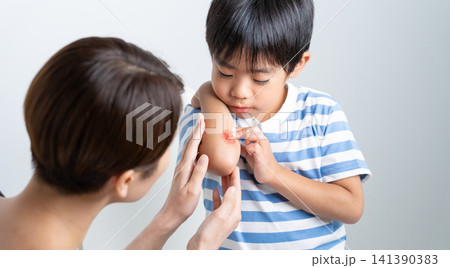 腕に擦り傷の怪我をする子供と手当てする母親・特殊メイク 腕に擦り傷の怪我をする子供と手当てする母親・特殊メイク 141390383