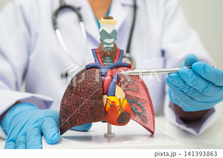 Pneumonia, lung cancer, Asian doctor holding human model. Pneumonia, lung cancer, Asian doctor holding human model. 141393863
