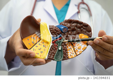 Cirrhosis, Liver cancer, fatty liver, Asian doctor with liver human model. Cirrhosis, Liver cancer, fatty liver, Asian doctor with liver human model. 141394831