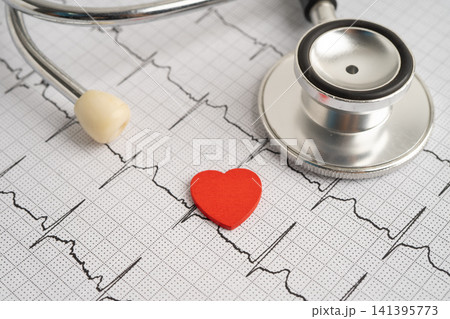 Electrocardiogram ECG, heart wave, heart attack, cardiogram report. Electrocardiogram ECG, heart wave, heart attack, cardiogram report. 141395773