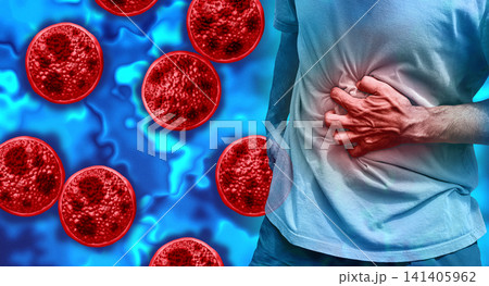 Cyclosporiasis disease Outbreak Cyclosporiasis disease Outbreak 141405962