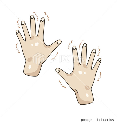 Illustration of trembling hands Illustration of trembling hands 141434109