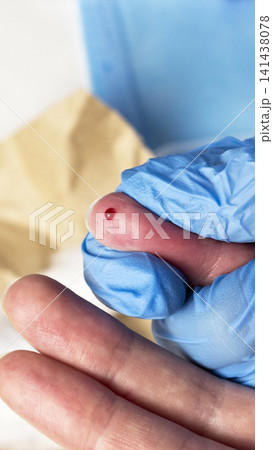 Close-up finger of person wearing blue medical glove shows small drop of blood on fingertip ready for medical testing or diagnostic procedure vertical photo, hemoglobin Close-up finger of person wearing blue medical glove shows small drop of blood on fingertip ready for medical testing or diagnostic procedure vertical photo, hemoglobin 141438078