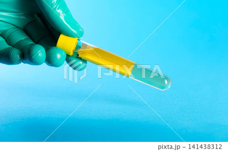 A laboratory technician's hand, wearing a medical glove, holds a urine sample for bacterial culture against a blue background. Concept of urine culture for enterobacteria and E. coli, enterococci, and 141438312