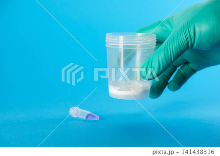 A doctor holds a medical container with ejaculate in his hand against a blue background. Conceptual illustration of a spermogram test for sperm motility and the male reproductive system. Copy space A doctor holds a medical container with ejaculate in his hand against a blue background. Conceptual illustration of a spermogram test for sperm motility and the male reproductive system. Copy space 141438316