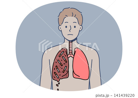 Man smoker with destroyed lungs is forced to suffer due to addiction to tobacco and nicotine 141439220