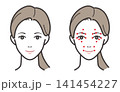 女性の顔のツボの位置と素顔の比較イラスト2点セット（ツボ押し・マッサージ・フェイシャルケア・美容針） 141454227