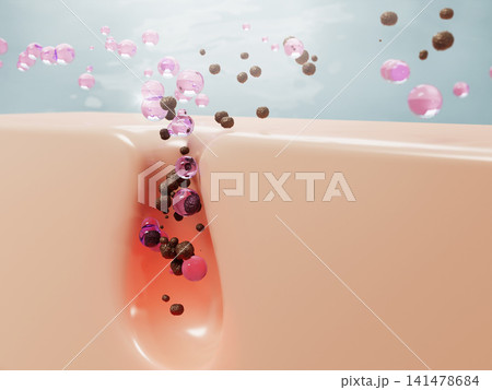3d cleansing clogged pores with pink gel bubbles. Face cleanser, rose water toner or lotion drops, liquid cosmetic spheres for skin care. Acne treatment, remove blackheads, ad banner. 3D illustration 141478684
