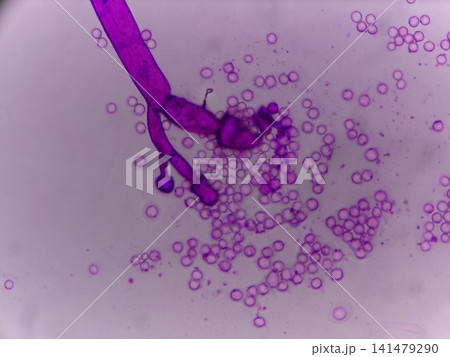 ケカビの分生子 ケカビの分生子 141479290