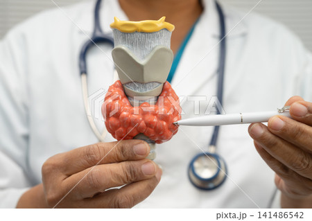 Hyperthyroidism, Overactive Thyroid, Thyroid Lymphoma, Asian doctor with thyroid gland human anatomy model in hospital. 141486542