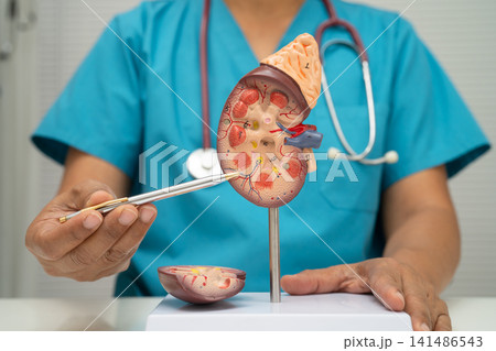 Chronic kidney disease, doctor with model for treatment urinary system, urology, Estimated glomerular filtration rate eGFR. 141486543