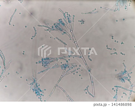 子嚢菌類のペニシリウム属のカビ 子嚢菌類のペニシリウム属のカビ 141486898