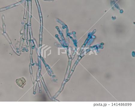 ペニシリウム属の分生子 ペニシリウム属の分生子 141486899