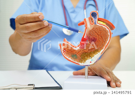 Stomach disease, doctor holding anatomy model for study diagnosis and treatment in hospital. Stomach disease, doctor holding anatomy model for study diagnosis and treatment in hospital. 141495791