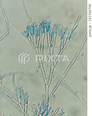 きれいに伸びたペニシリウムの分生子 きれいに伸びたペニシリウムの分生子 141500790