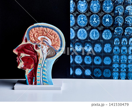 Brain cross section anatomical model beside MRI images on doctor desk. Neurosurgery and radiology concept Brain cross section anatomical model beside MRI images on doctor desk. Neurosurgery and radiology concept 141530479