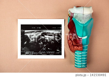 Thyroid gland anatomical model with ultrasound image in medical clinic. Thyroid diagnosis and patient examination Thyroid gland anatomical model with ultrasound image in medical clinic. Thyroid diagnosis and patient examination 141530491