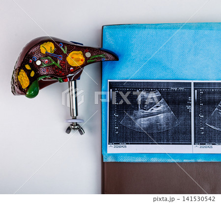 Liver screening and diagnosis. Anatomy liver model with ultrasound printouts in medical clinic Liver screening and diagnosis. Anatomy liver model with ultrasound printouts in medical clinic 141530542